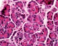 Pancreas histology 102.jpg
