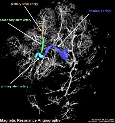 Human placenta vascular MRI 02.jpg