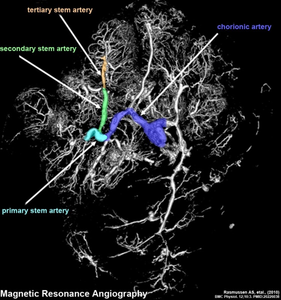 File:Human placenta vascular MRI 02.jpg