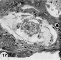 Carnegie 8215 embryo, chorionic cavity and trophoblast