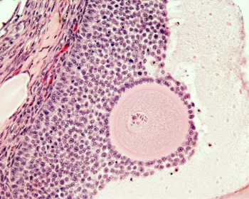 Ovary- histology secondary follicle 01.jpg