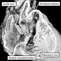 fig 35a Mouse heart both arterial trunks right ventricle and interventricular communication