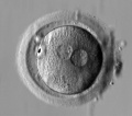 Human zygote two pronuclei PMID 20579351