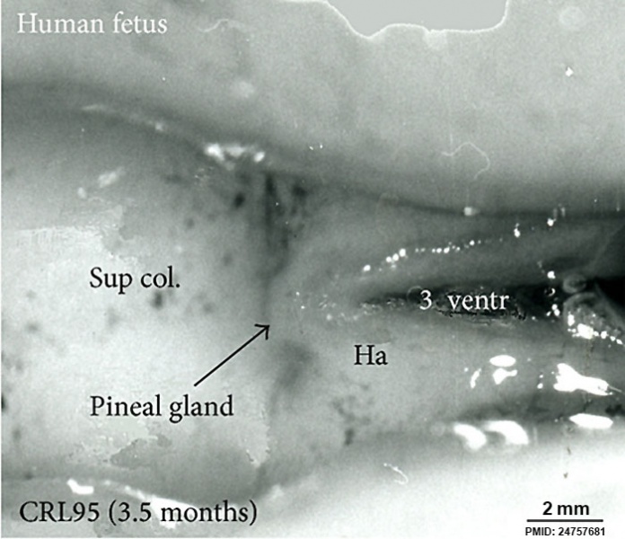 File:Fetal pineal gland 01.jpg