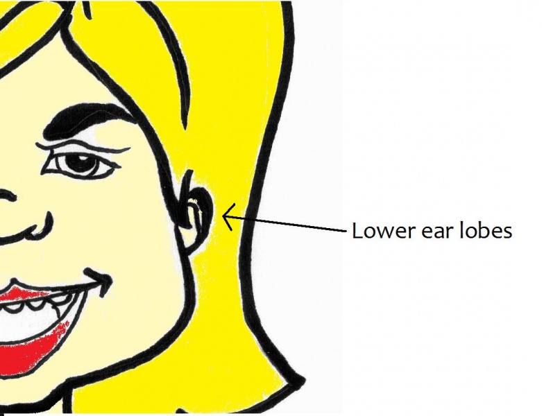 File:Lowered Ear Lobes.jpg
