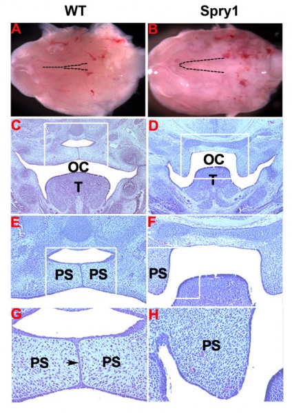 File:Mouse - Spry1 cleft palate.jpg