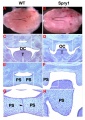 Mouse - Spry1 cleft palate
