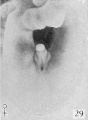 Fig. 29. No. 2250b, 36 mm., female. X 4.