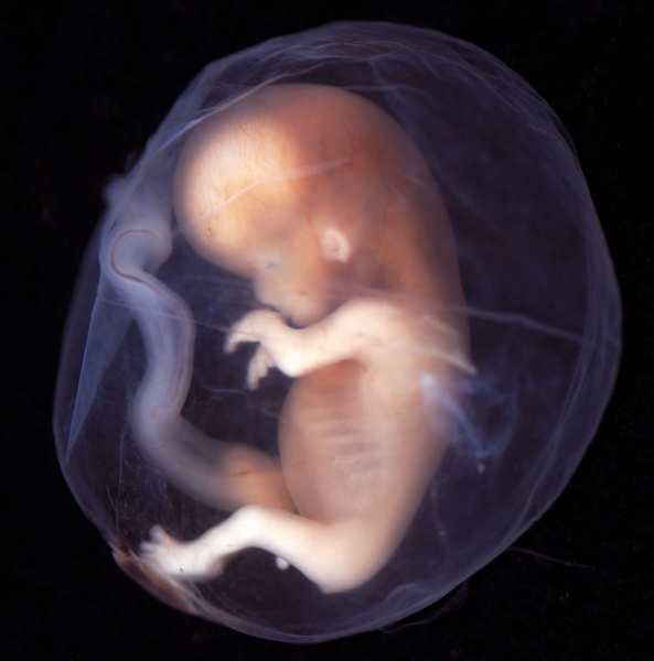 File:Human- fetal week 10 bf01.jpg