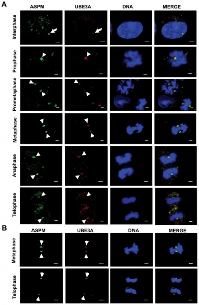File:UBE3A colocalizes with ASPM at the centrosome throughout mitosis.jpg