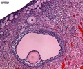 Ovary histology (cat) showing follicle stages