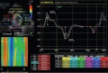 Speckle Tracking Echocardiograph
