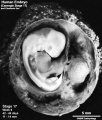 Embryo and membranes