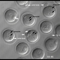 Mouse blastocyst movie pronuclei.jpg