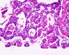Endocrine - Parathyroid Development - Embryology