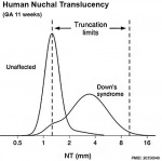 nuchal translucency