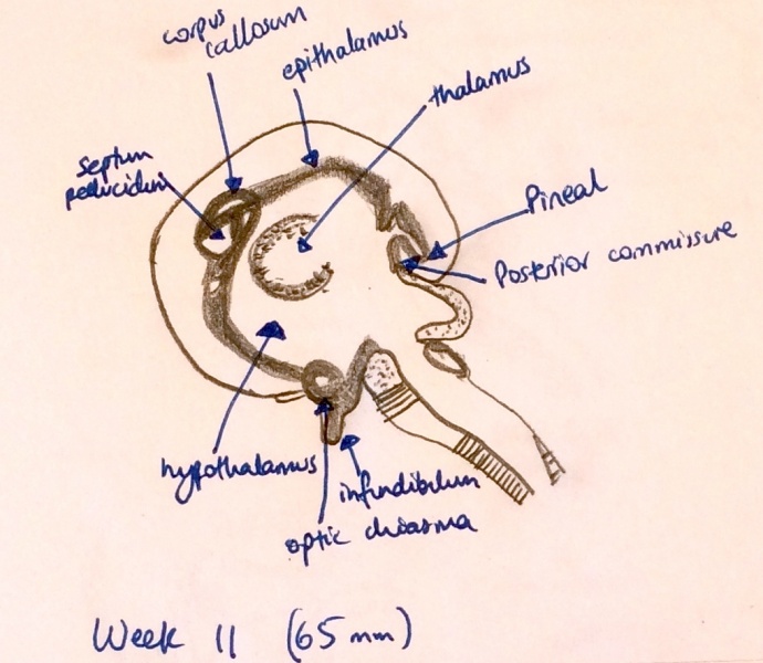 File:Week 11 fetal development of CNS.jpg