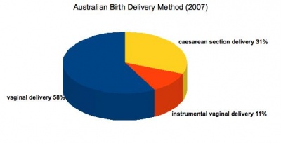 Australian birth delivery method 2007.jpg